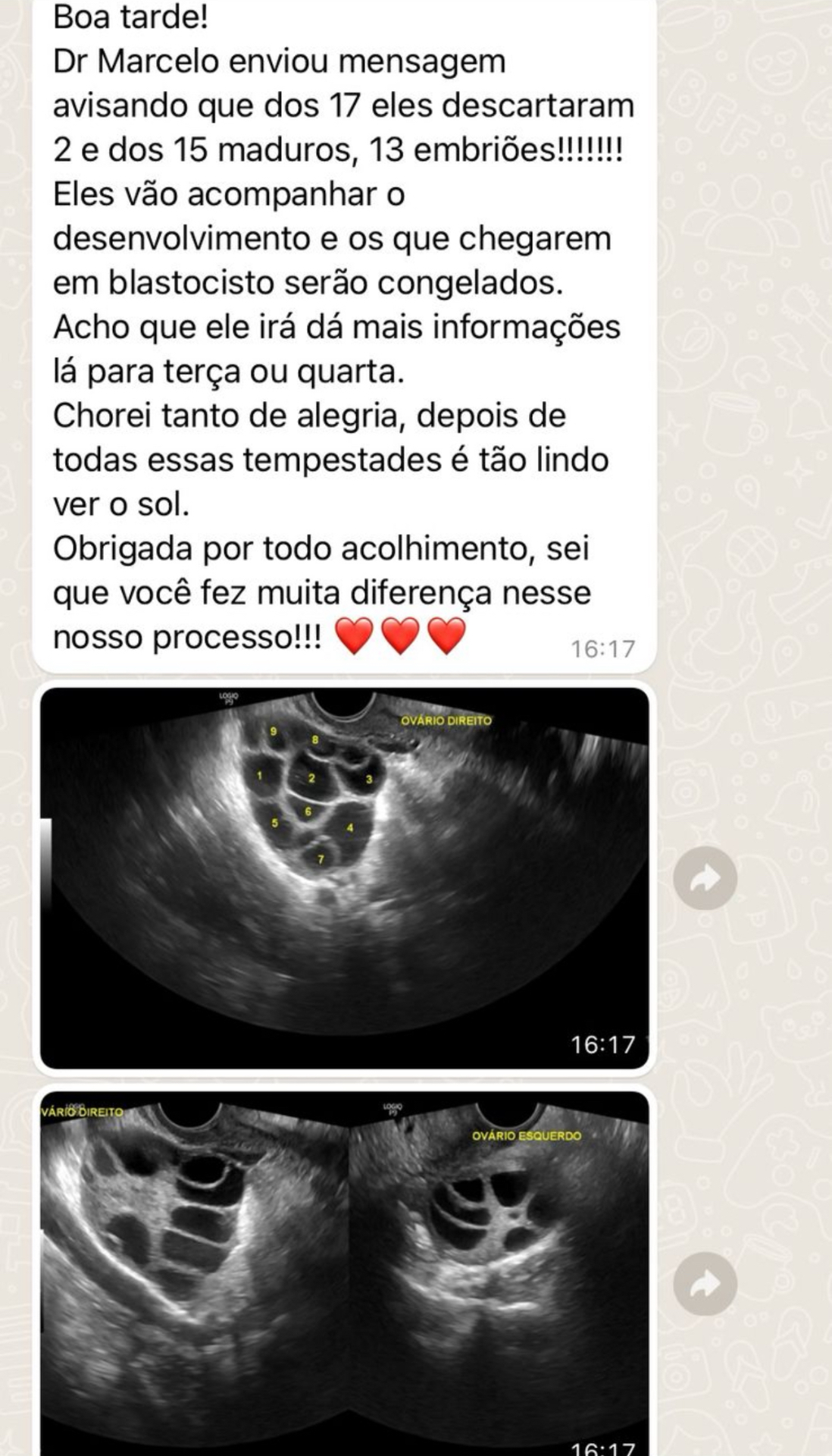 Depoimento real de uma paciente 10
